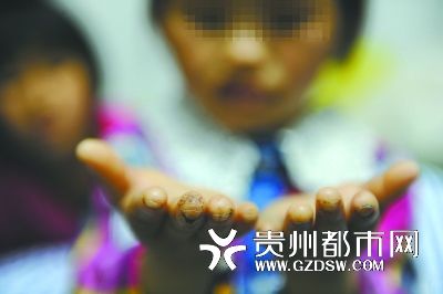 指尖被針扎得傷痕累累。
