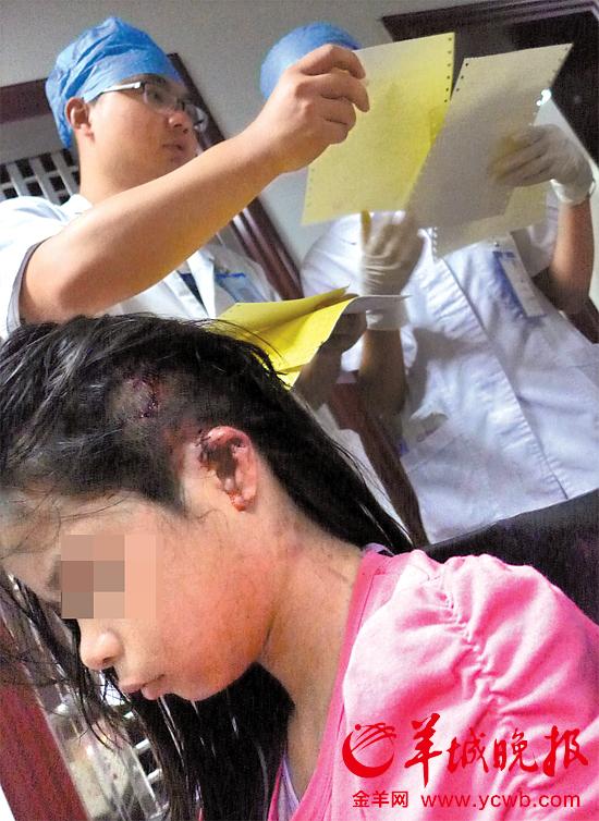 受傷的11歲女孩頭發(fā)被卷入扶梯，耳朵被嚴重拉傷，需手術。