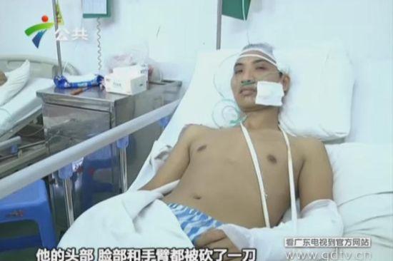 另一名傷者頭部、臉部和手臂都被砍了一刀。(視頻截圖)