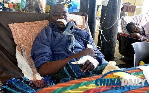 雖然已經(jīng)在醫(yī)院接受了近一個月的恢復治療，卡托卡的身體仍然非常虛弱。
