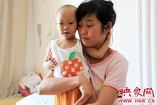 孩子和媽媽在一起，她的右眼已經(jīng)失明。