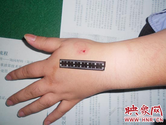 為幫助無(wú)證駕駛的朋友逃避處罰，新鄉(xiāng)的王某竟對(duì)執(zhí)勤民警大打出手，還將一名民警的手臂咬傷