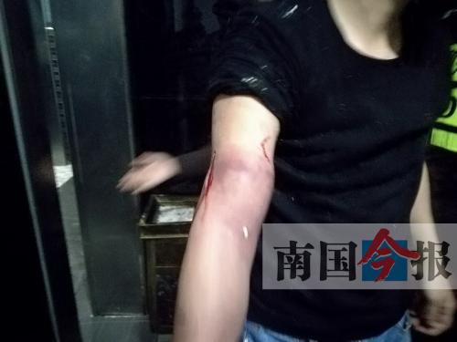 覃先生手臂被卡的部位受傷流血，所幸傷勢無大礙。 通訊員 王建民 攝