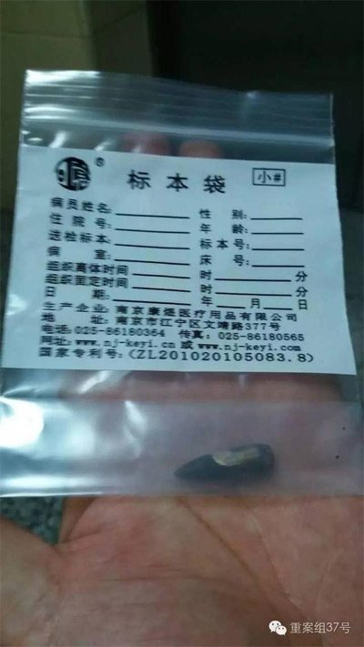 經(jīng)警方鑒定，秦女士體內(nèi)取出的子彈系56式步槍射出 。 受訪者供圖