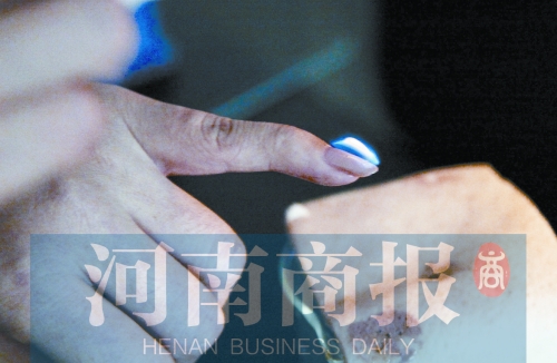 將指甲油涂在指甲上，靠近火焰時被引燃了
