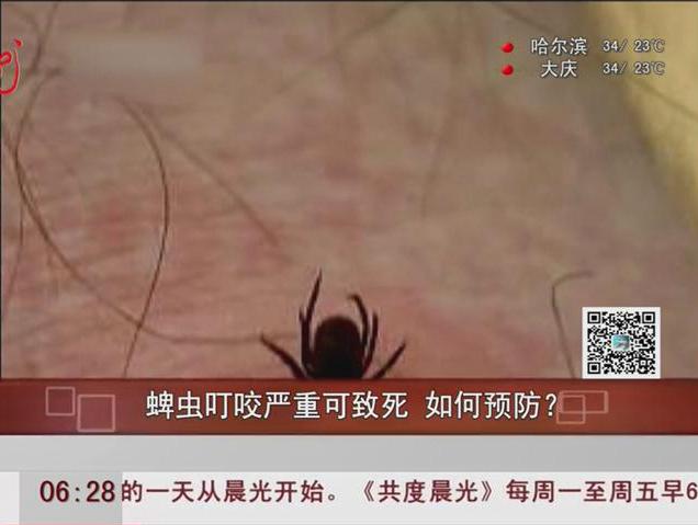 蜱蟲(chóng)叮咬嚴(yán)重可致死如何預(yù)防？